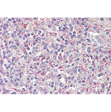 Immunohistochemistry - Anti-TRIB1 Antibody (A84501) - Antibodies.com