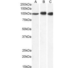 Western Blot - Anti-MTHFD1 Antibody (A84503) - Antibodies.com