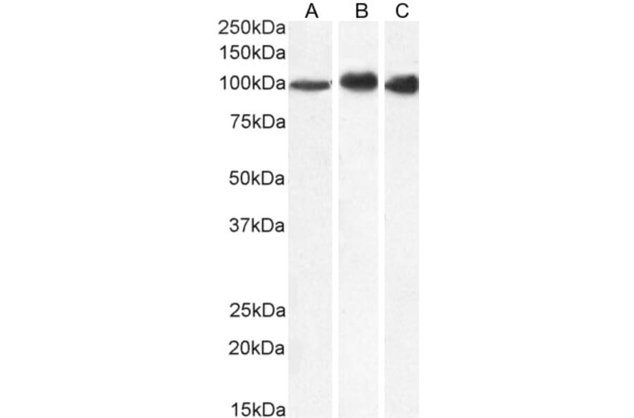 Western Blot - Anti-MTHFD1 Antibody (A84503) - Antibodies.com