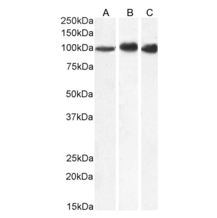 Western Blot - Anti-MTHFD1 Antibody (A84503) - Antibodies.com