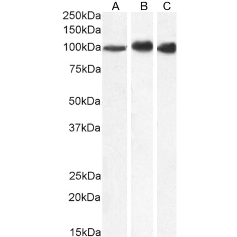 Western Blot - Anti-MTHFD1 Antibody (A84503) - Antibodies.com