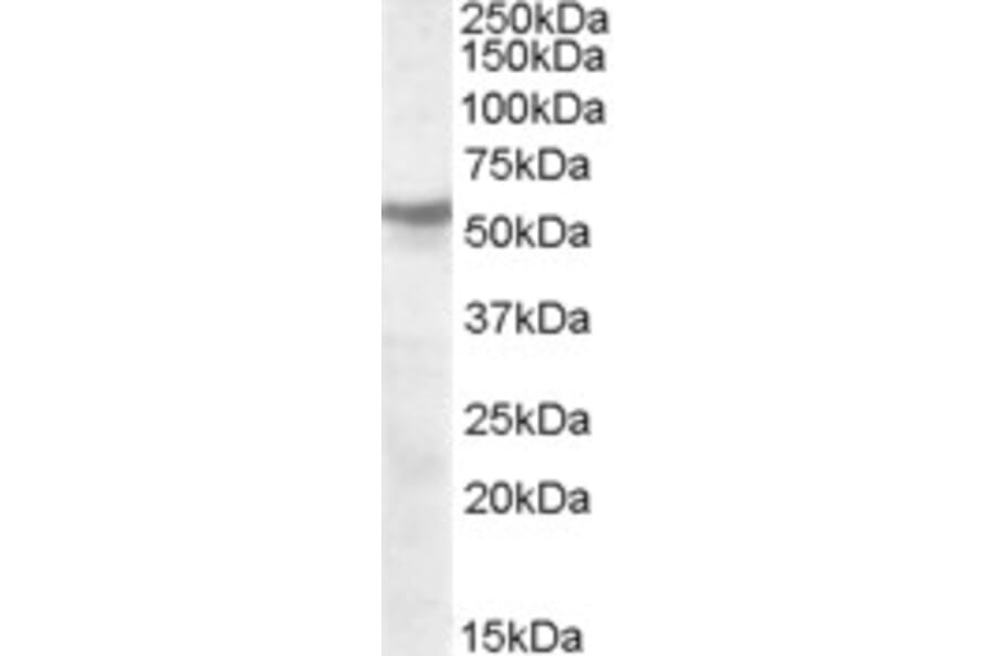 Western Blot - Anti-CHRNB1 Antibody (A84504) - Antibodies.com