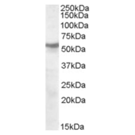 Western Blot - Anti-CHRNB1 Antibody (A84504) - Antibodies.com