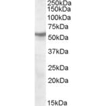 Western Blot - Anti-CHRNB1 Antibody (A84504) - Antibodies.com