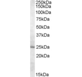 Western Blot - Anti-MTHFS Antibody (A84505) - Antibodies.com