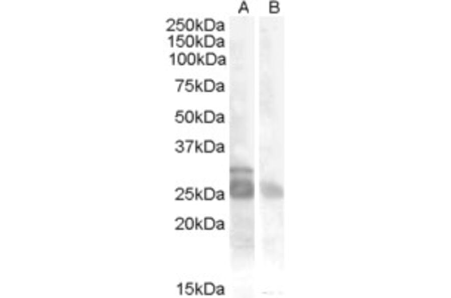 Western Blot - Anti-Myf5 Antibody (A84507) - Antibodies.com