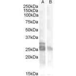 Western Blot - Anti-Myf5 Antibody (A84507) - Antibodies.com