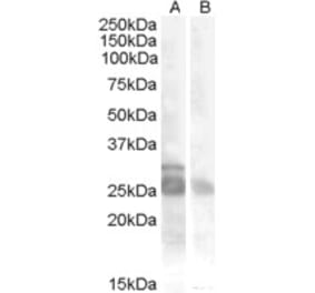Western Blot - Anti-MYF5 Antibody (A84507) - Antibodies.com
