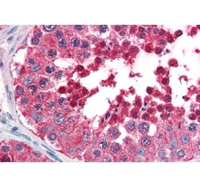 Immunohistochemistry - Anti-HSPA4L Antibody (A84508) - Antibodies.com