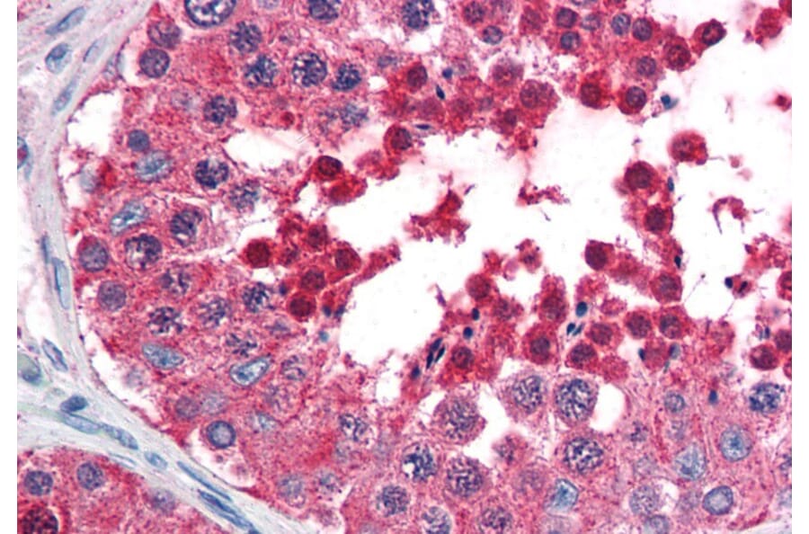 Immunohistochemistry - Anti-HSPA4L Antibody (A84508) - Antibodies.com