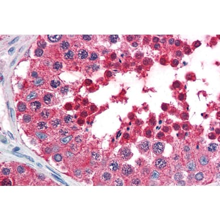 Immunohistochemistry - Anti-HSPA4L Antibody (A84508) - Antibodies.com