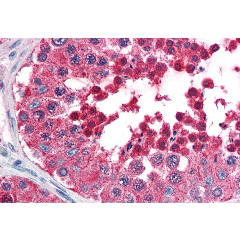 Immunohistochemistry - Anti-HSPA4L Antibody (A84508) - Antibodies.com