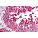 Immunohistochemistry - Anti-HSPA4L Antibody (A84508) - Antibodies.com