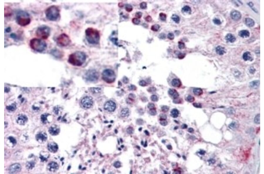 Immunohistochemistry - Anti-Frizzled 9 Antibody (A84509) - Antibodies.com