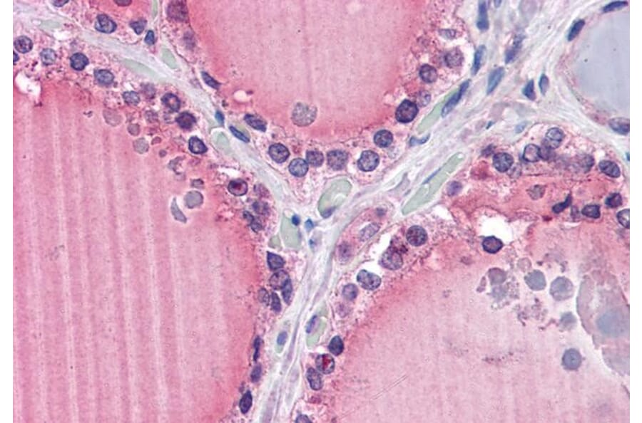 Immunohistochemistry - Anti-Frizzled 9 Antibody (A84509) - Antibodies.com