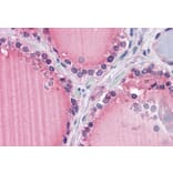 Immunohistochemistry - Anti-Frizzled 9 Antibody (A84509) - Antibodies.com