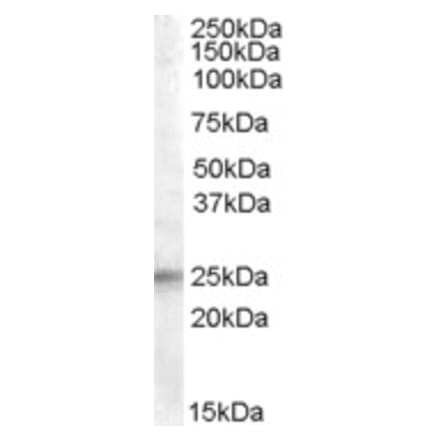 Western Blot - Anti-IGFBP6 Antibody (A84511) - Antibodies.com