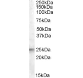 Western Blot - Anti-IGFBP6 Antibody (A84511) - Antibodies.com