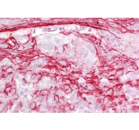 Immunohistochemistry - Anti-IGFBP7 Antibody (A84512) - Antibodies.com