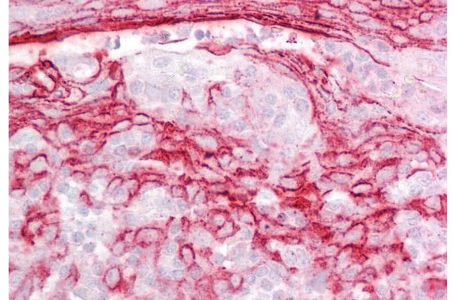 Immunohistochemistry - Anti-IGFBP7 Antibody (A84512) - Antibodies.com