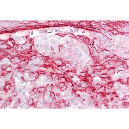 Immunohistochemistry - Anti-IGFBP7 Antibody (A84512) - Antibodies.com