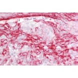 Immunohistochemistry - Anti-IGFBP7 Antibody (A84512) - Antibodies.com