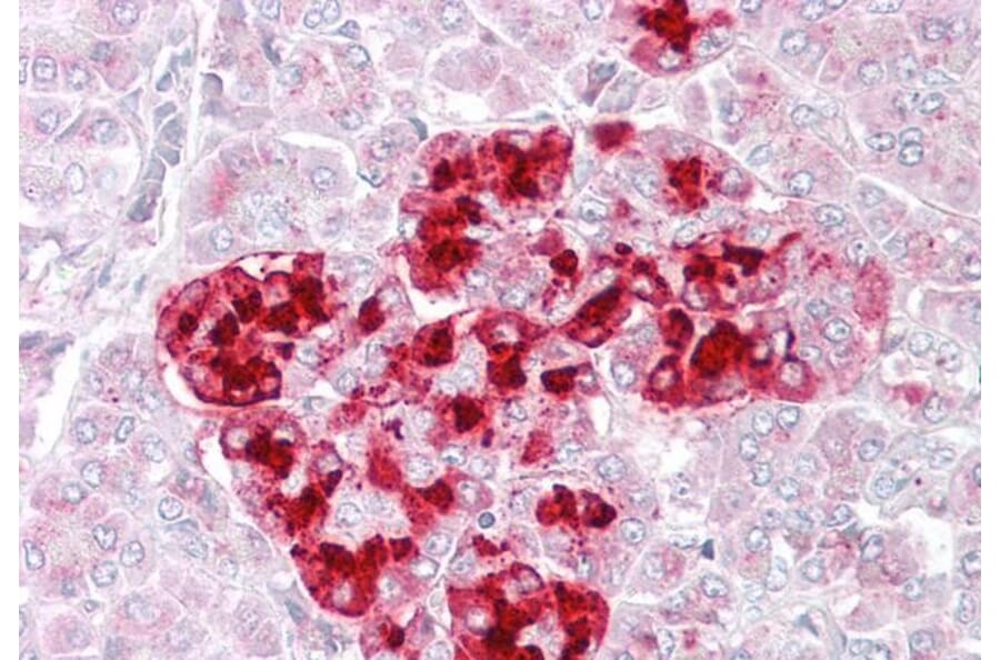 Immunohistochemistry - Anti-IGFBP7 Antibody (A84512) - Antibodies.com