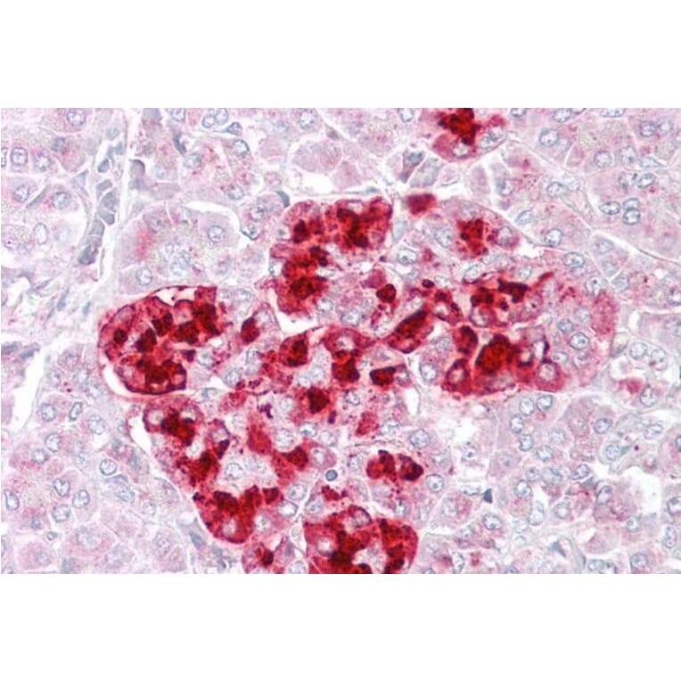 Immunohistochemistry - Anti-IGFBP7 Antibody (A84512) - Antibodies.com