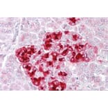 Immunohistochemistry - Anti-IGFBP7 Antibody (A84512) - Antibodies.com