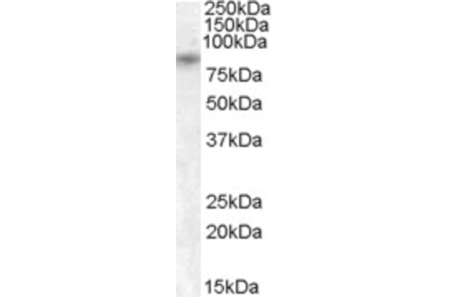 Western Blot - Anti-TRPV5 Antibody (A84513) - Antibodies.com