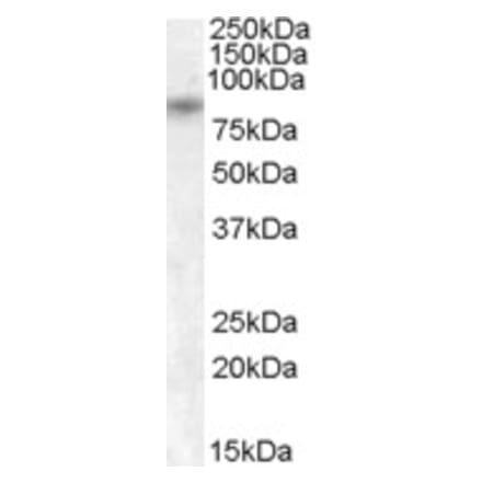 Western Blot - Anti-TRPV5 Antibody (A84513) - Antibodies.com