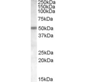 Western Blot - Anti-CHRNB3 Antibody (A84517) - Antibodies.com