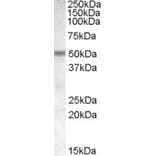 Western Blot - Anti-CHRNB3 Antibody (A84517) - Antibodies.com