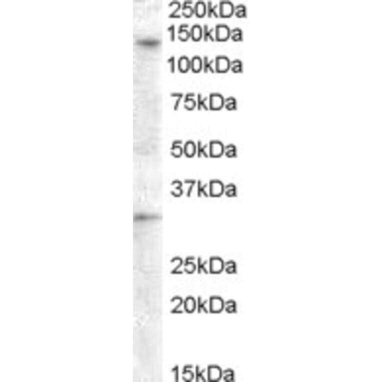 Western Blot - Anti-GPCR GPR125 Antibody (A84518) - Antibodies.com