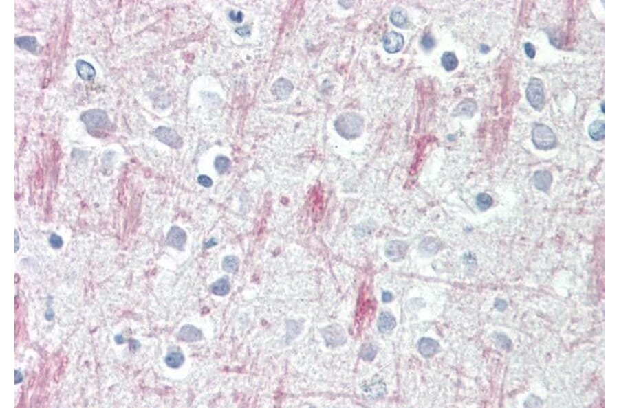 Immunohistochemistry - Anti-GPCR GPR125 Antibody (A84518) - Antibodies.com