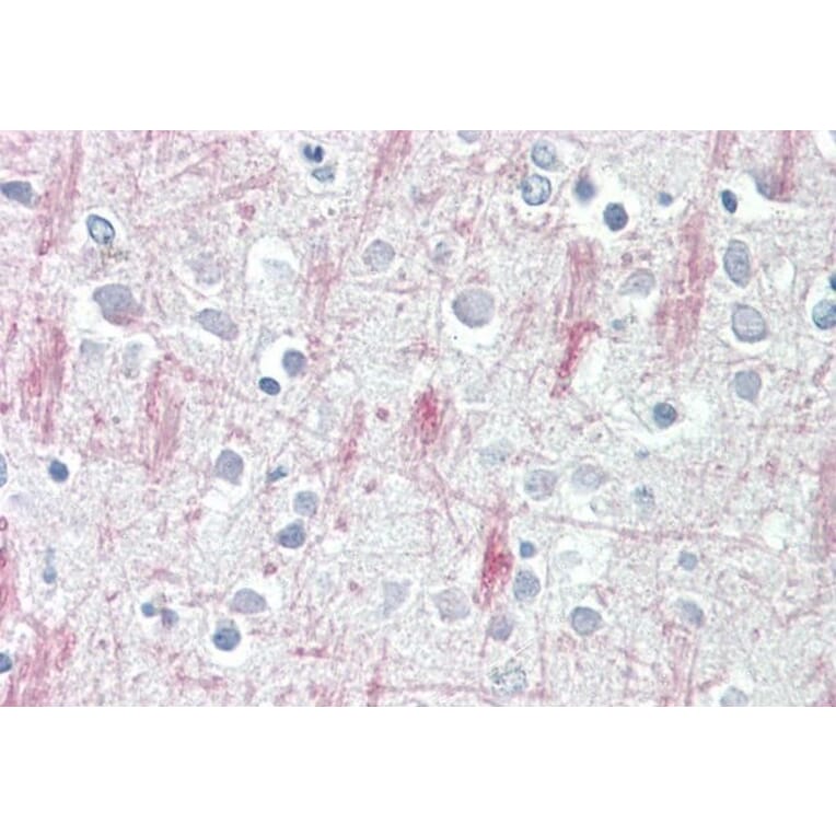 Immunohistochemistry - Anti-GPCR GPR125 Antibody (A84518) - Antibodies.com