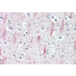 Immunohistochemistry - Anti-GPCR GPR125 Antibody (A84518) - Antibodies.com