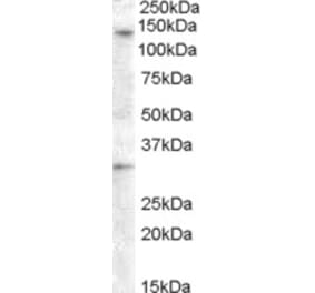 Western Blot - Anti-GPR125 Antibody (A84518) - Antibodies.com