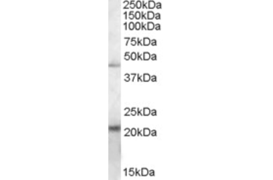 Western Blot - Anti-TXNDC4 Antibody (A84520) - Antibodies.com
