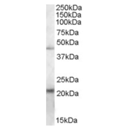 Western Blot - Anti-TXNDC4 Antibody (A84520) - Antibodies.com