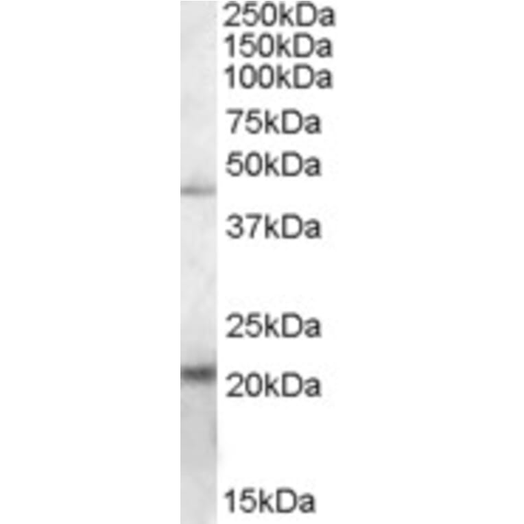 Western Blot - Anti-TXNDC4 Antibody (A84520) - Antibodies.com