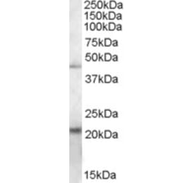 Western Blot - Anti-TXNDC4 Antibody (A84520) - Antibodies.com