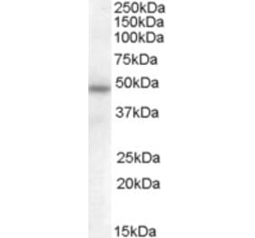 Western Blot - Anti-SERPINA12 Antibody (A84521) - Antibodies.com