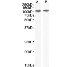 Western Blot - Anti-IRE1 Antibody (A84523) - Antibodies.com