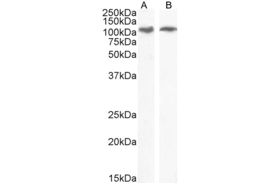 Western Blot - Anti-IRE1 Antibody (A84523) - Antibodies.com