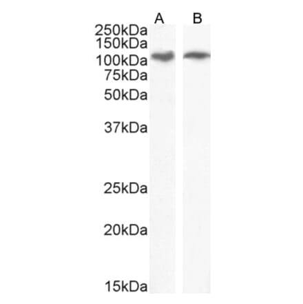 Western Blot - Anti-IRE1 Antibody (A84523) - Antibodies.com