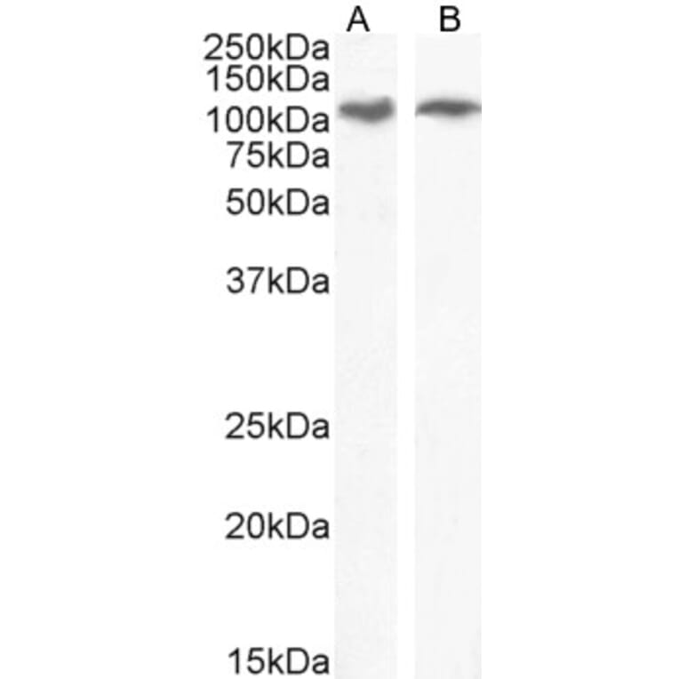 Western Blot - Anti-IRE1 Antibody (A84523) - Antibodies.com