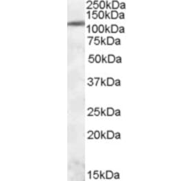 Western Blot - Anti-ERN1 Antibody (A84523) - Antibodies.com