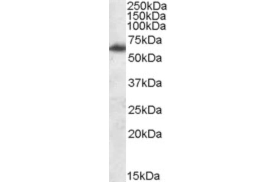 Western Blot - Anti-FTO Antibody (A84524) - Antibodies.com