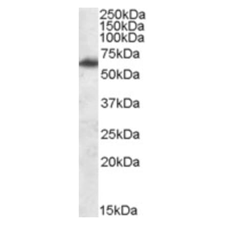 Western Blot - Anti-FTO Antibody (A84524) - Antibodies.com